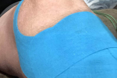 knee2